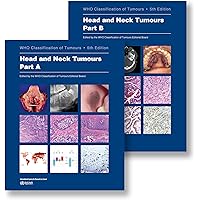 健康・医学 WHO Classification of Tumours Amazon | Haematolymphoid Tumours: Who Classification of
